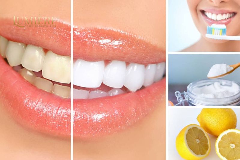 Bật mí cách tẩy trắng răng ố vàng đơn giản cực hiệu quả 2 Hướng dẫn cách tẩy trắng răng ố vàng tại nhà đơn giản nhất