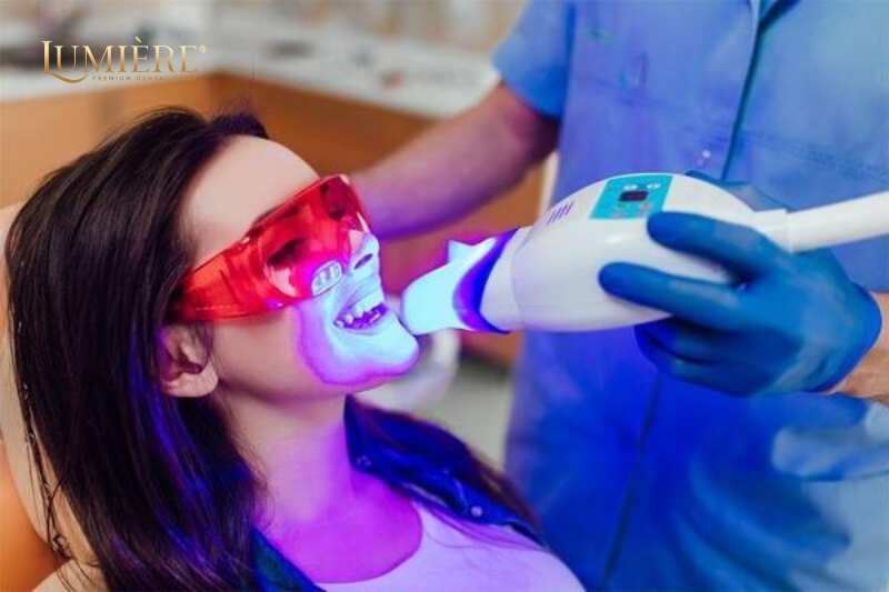 Đèn tẩy trắng răng có phải là phương pháp tốt để làm trắng răng hay không? 1 Những trường hợp nên tẩy trắng răng