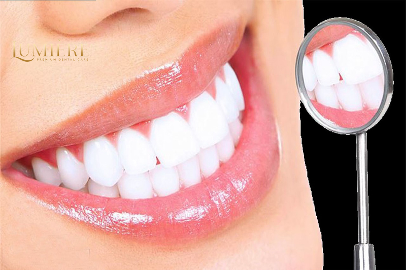 Bật mí những điều bạn cần biết về dịch vụ tẩy trắng răng 1 Tẩy trắng răng có làm ê buốt không?