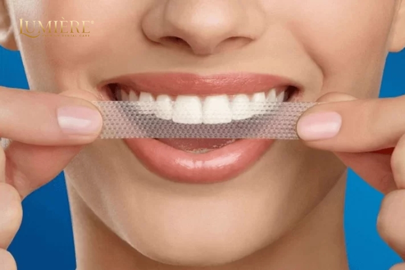 Hướng dẫn cách dùng và những lưu ý khi dùng miếng dán trắng răng 1 Miếng dán làm trắng răng là gì?