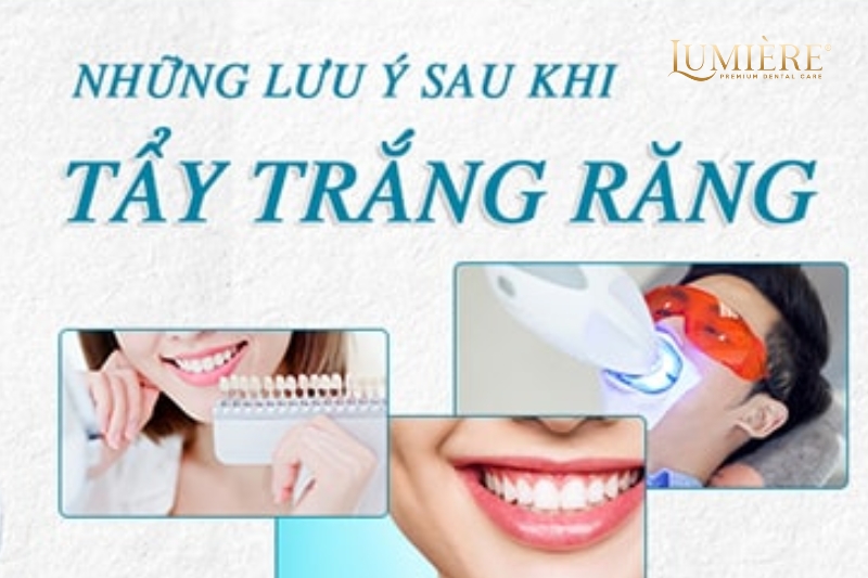 Top 3 các phương pháp tẩy trắng răng an toàn nhất hiện nay 4 Lưu ý khi tẩy trắng răng