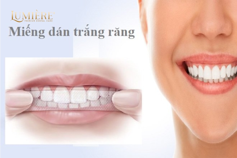 Top 3 các phương pháp tẩy trắng răng an toàn nhất hiện nay 1 Phương pháp tẩy trắng răng bằng miếng dán
