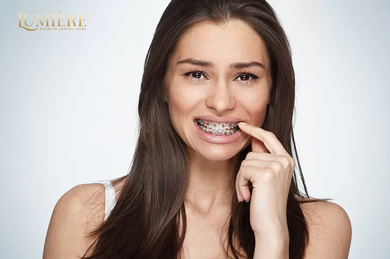 Nhổ răng để niềng có ảnh hưởng gì không đến sức khỏe