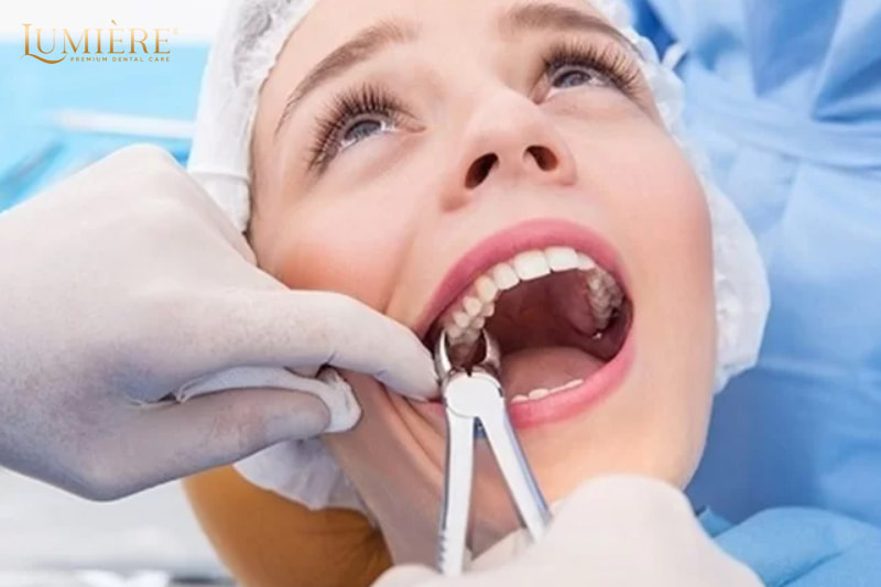 Nhổ răng số 6 có nguy hiểm không? Lời khuyên từ bác sĩ nha khoa 2 Nhổ răng số 6 có nguy hiểm không?