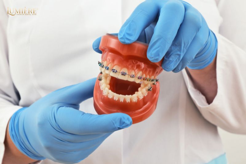 Tư tin tỏa sáng cùng Lumière Dental: Địa chỉ niềng răng uy tín 3 Tại sao nên chọn Lumière Dental là địa chỉ niềng răng?