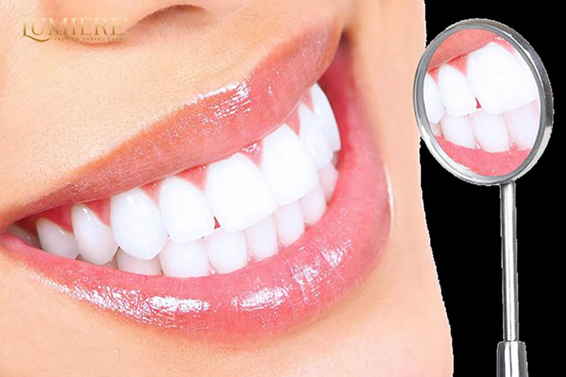 Tẩy trắng răng tại phòng khám: Quy trình tẩy trắng hiệu quả 2 Sau khi tẩy trắng răng có bị vàng lại không?