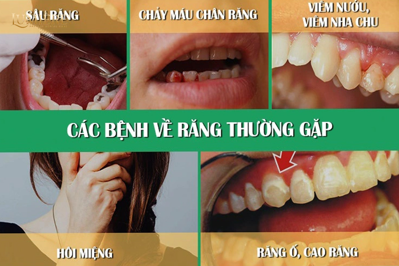 Cách phòng ngừa các vấn đề sức khỏe răng miệng phổ biến 2 Cách để phòng ngừa các vấn đề sức khỏe răng miệng phổ biến
