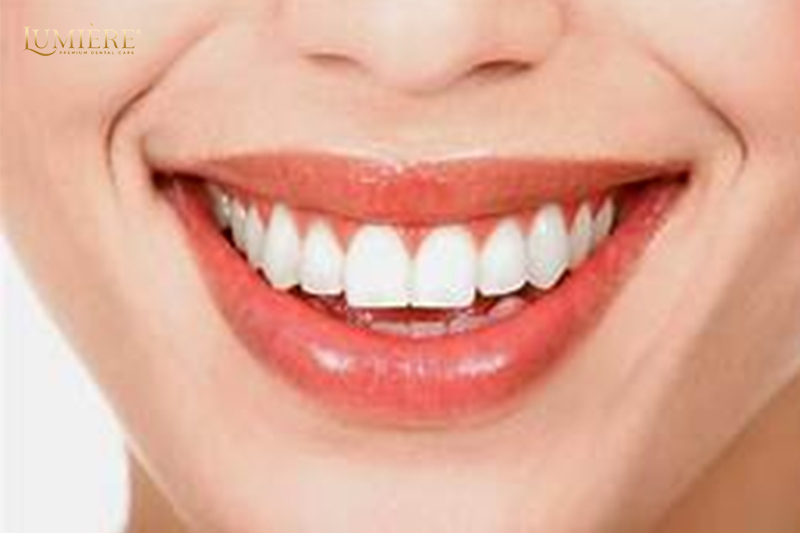 Cách phòng ngừa các vấn đề sức khỏe răng miệng phổ biến 1 Các vấn đề sức khỏe răng miệng gồm những gì?