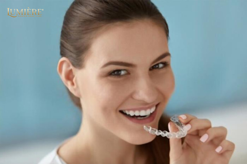 Hàm duy trì sau niềng răng: Khí cụ quan trọng không thể thiếu 1 Hàm duy trì sau khi niềng răng là gì?
