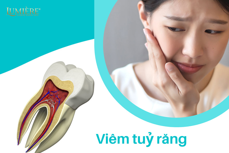Cách phòng ngừa và điều trị viêm tủy răng hiệu quả 2 Cách phòng ngừa viêm tủy răng đơn giản bạn nên biết