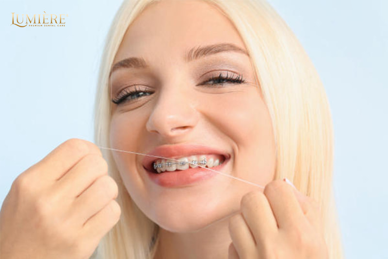 Giải đáp thắc mắc về niềng răng: Bí quyết sở hữu nụ cười hoàn hảo 3 Nuốt mắc cài niềng răng có gây ảnh hưởng như thế nào?