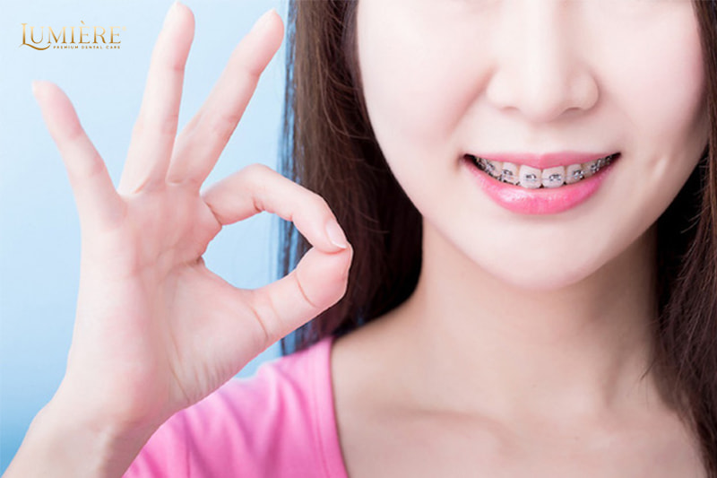 Giải đáp thắc mắc về niềng răng: Bí quyết sở hữu nụ cười hoàn hảo 1 Niềng răng có đau không