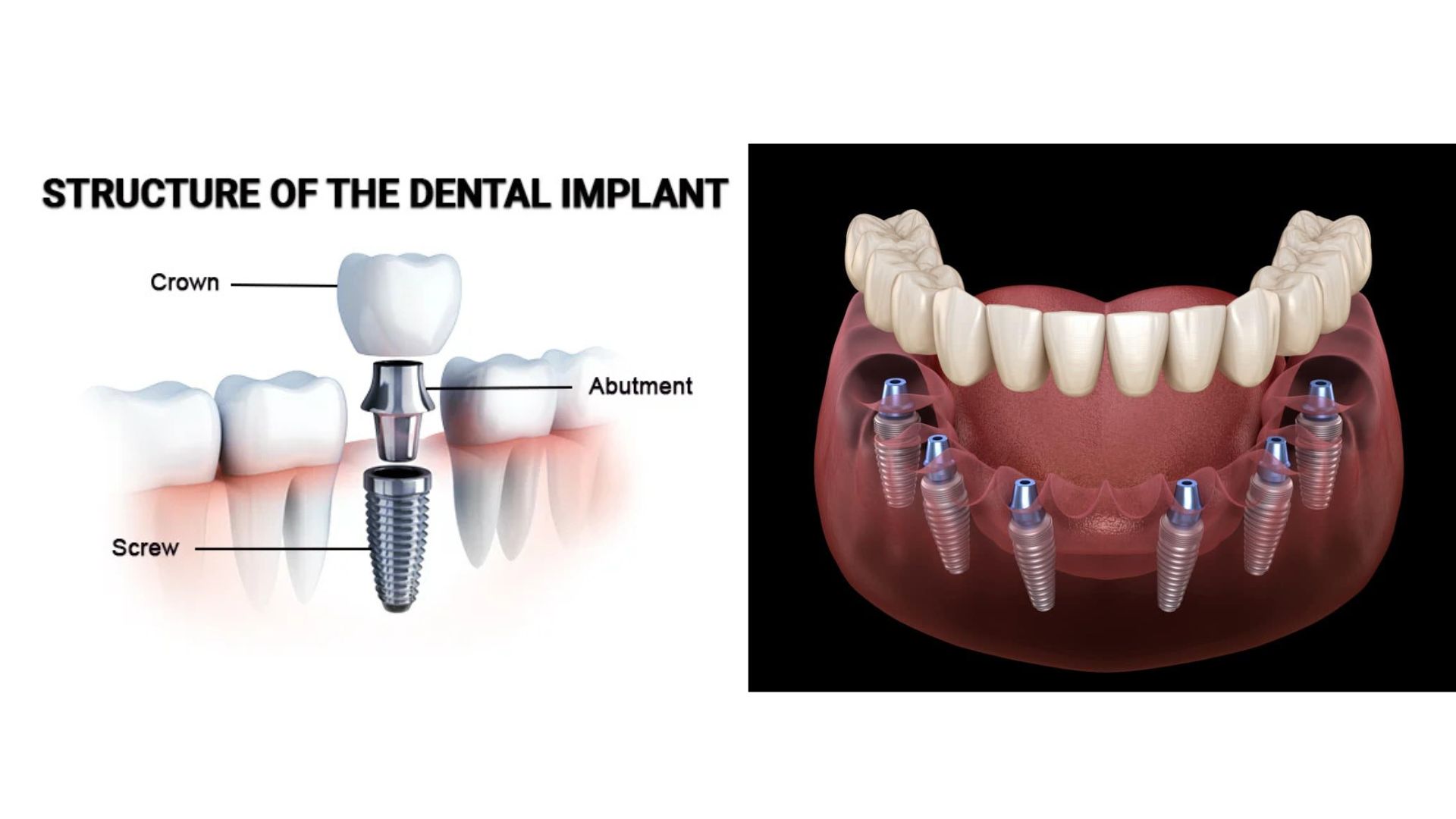 Nha khoa thẩm mỹ 