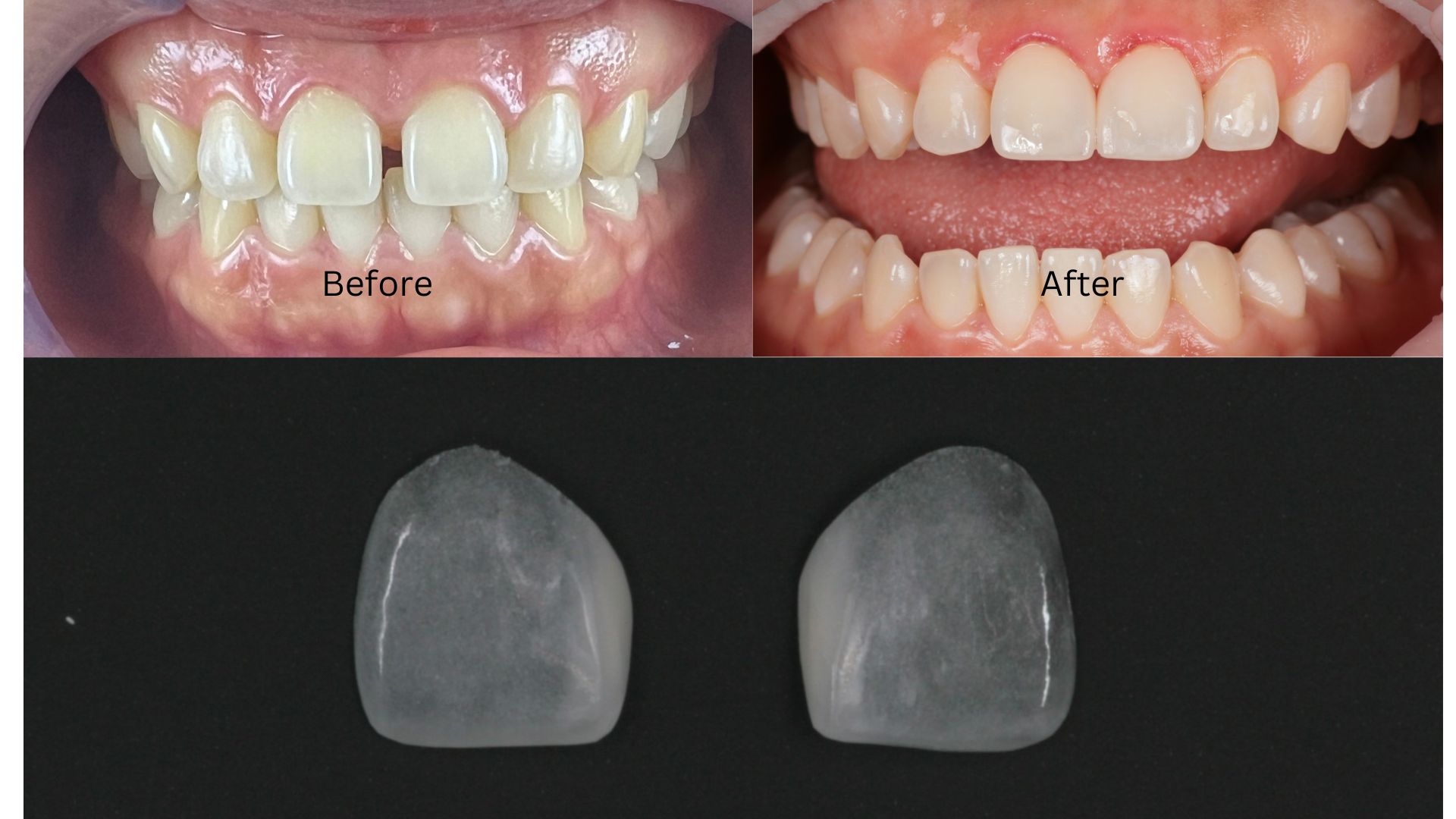 Nha khoa thẩm mỹ 