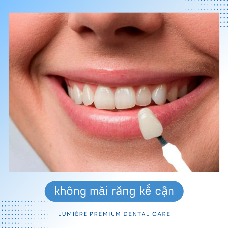 🦷 PHỤC HỒI RĂNG MẤT TỐI ƯU VỚI CẤY GHÉP IMPLANT – GIẢI PHÁP TOÀN DIỆN CHO NỤ CƯỜI HOÀN HẢO ✨ 3 3