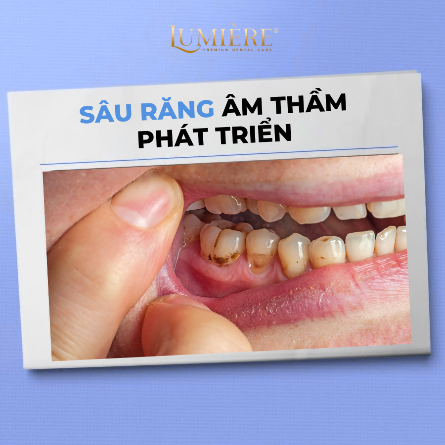 Ban tin ⚠️ DUNG XEM NHE VIEC KHONG KHAM RANG DINH KY 🦷 2