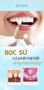 BOC SU CO PHAI MAI HET RANG THAT KHONG