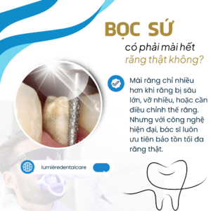 BOC SU CO PHAI MAI HET RANG THAT KHONG 1