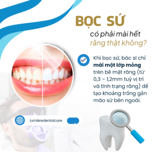 BOC SU CO PHAI MAI HET RANG THAT KHONG 2