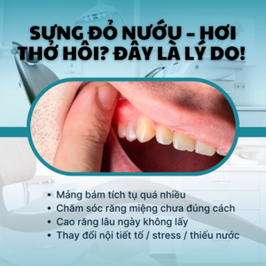 SUNG DO NUOU – HOI THO HOI DAY LA LY DO ✨