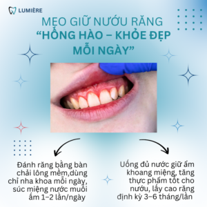 SUNG DO NUOU – HOI THO HOI DAY LA LY DO ✨ 2