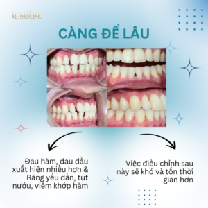 SAI KHOP CAN CO TU HET KHONG 1 2