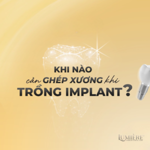 💥3 TRƯỜNG HỢP NÊN GHÉP XƯƠNG TRƯỚC KHI TRỒNG IMPLANT BẠN CẦN BIẾT!🦷 1 03 truong hop can ghep xuong truoc khi trong Implant