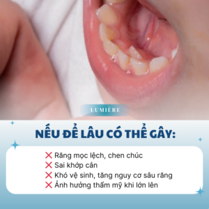 RANG VINH VIEN MOC SAU RANG SUA – CO PHAI BE DANG MOC 2 HAM RANG 1