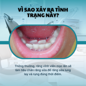 RANG VINH VIEN MOC SAU RANG SUA – CO PHAI BE DANG MOC 2 HAM RANG