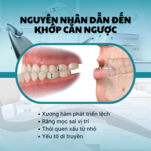 KHOP CAN NGUOC MOM GIO KHONG CON LA NOI LO 👌👌