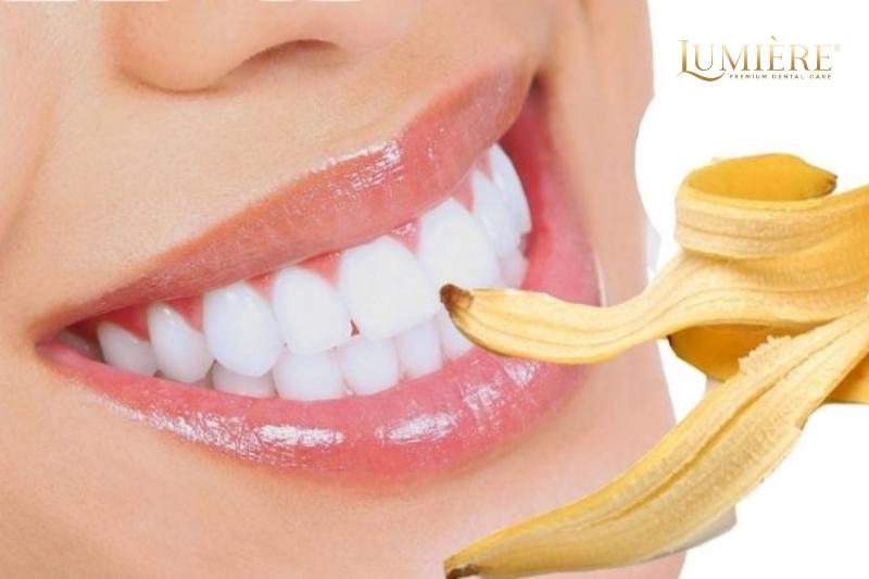 Mẹo tẩy trắng răng bằng vỏ chuối