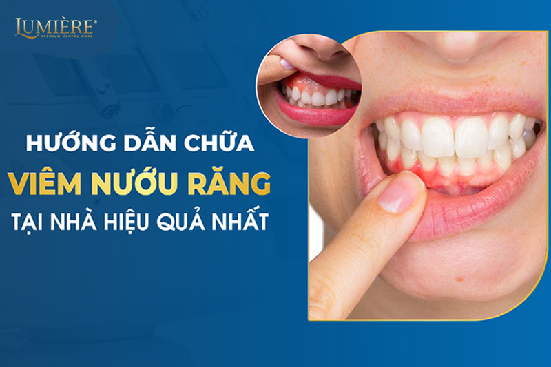 Chữa sưng nướu răng tại nhà: 5 phương pháp hiệu quả và an toàn 7 Chữa sưng nướu tại nhà